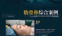 温哥华医美爆料案例视频